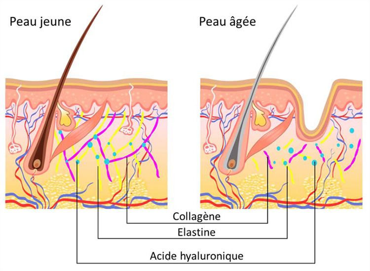 Les Bienfaits Du Collag ne Pour La Peau Mythe Ou R alit Nutrixeal Les Bienfaits Du Collag ne Pour La Peau Mythe Ou R alit Nutrixeal