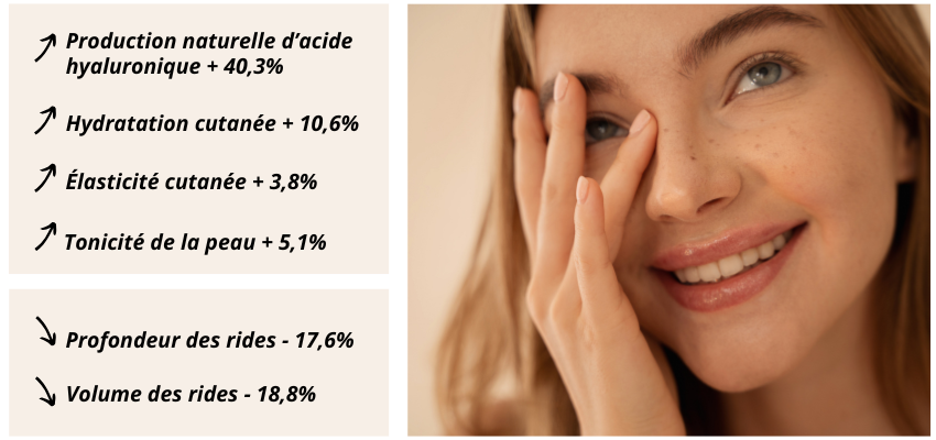 Bienfaits de l' Acide Hyaluronique ExceptionHYAL®